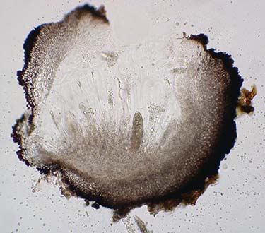 Agonimia tristicula; Perithecia section, Lichens of the Pacific Northwest