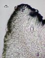 Caloplaca atrosanguinea