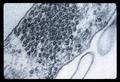 Cucumber mosaic virus in fleck under electron microscope, circa 1965