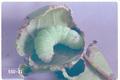 Amphipyra pyramidoides (Green fruitworm)