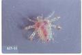 Pthirus pubis (Crab louse)