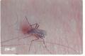 Aedes aegypti (Yellow fever mosquito)