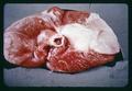 Calcification of leg of lamb, 1951