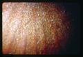 Closeup of filbert colored by nitric acid, Oregon State University, Corvallis, Oregon, 1967