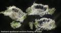 Varicellaria rhodocarpa