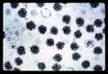 Turnip yellow mosaic virus under electron microscope, circa 1965