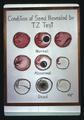 Condition of Seed Revealed by TZ Test illustration, 1974