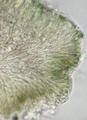 Lecidea turgidula